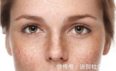 枇杷肉|女性一过40岁,要学会吃这7种食物,能养肝补肾淡化色斑