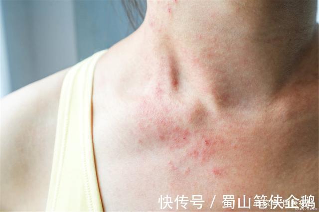 糖尿病患者|血糖不好的人，睡觉时常有3个表现，若你一个都不占，值得祝贺