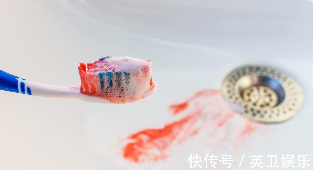 肝功能|手掌胸部出现这些表现,立即去医院查查肝,是肝硬化的前期表现