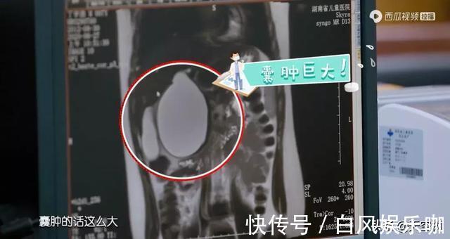 动手术|儿科医生曝光真实一天:医院,才是检验父母最残酷的地方……