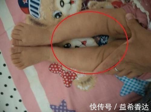 维生素d|为什么中国孩子那么多“罗圈腿”,外国却很少,只因家长这些行为