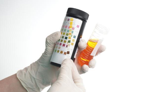 糖尿病肾病|一“尿”知肾,糖尿病患者:抬头看糖,低头看尿