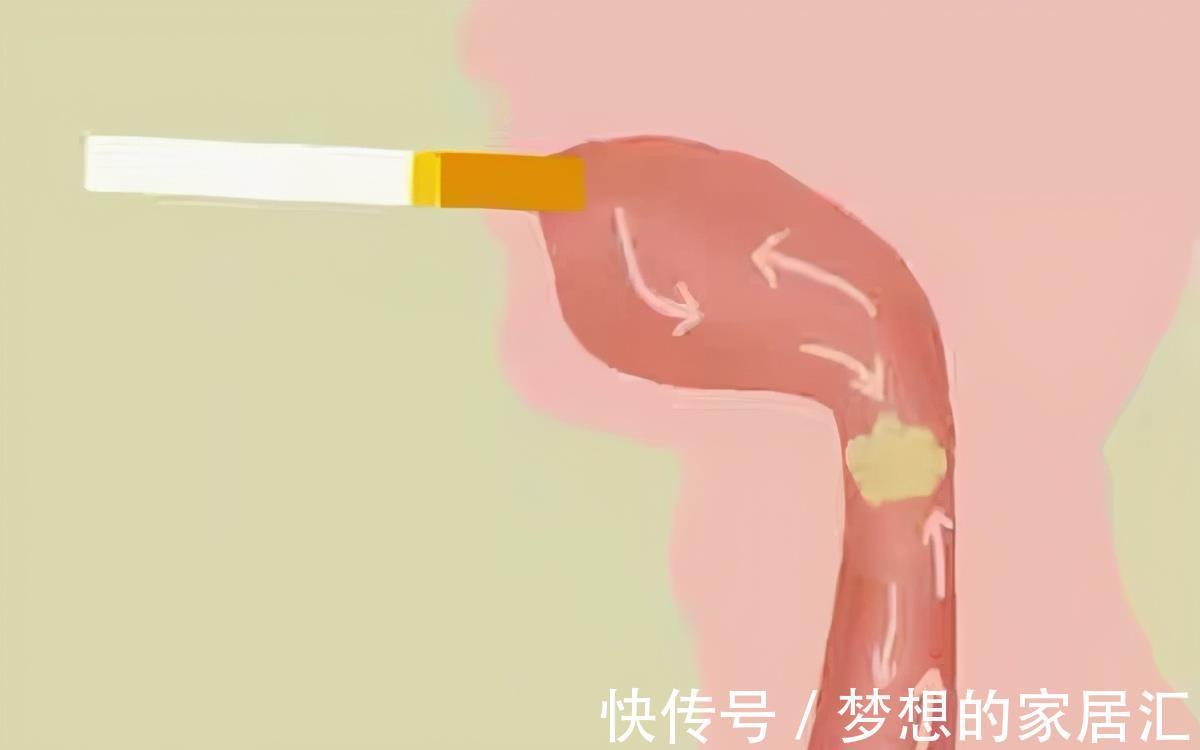 白痰|吐出的痰液颜色不同说明了什么？黑痰、黄痰、白痰，哪个更严重？