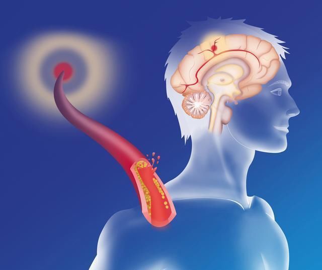 每天喝二两白酒和滴酒不沾的人,谁更易患癌?你错的很离谱