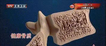 家人|补钙第一名竟是它！这份补钙排行榜，为了家人快收好，别乱吃了！
