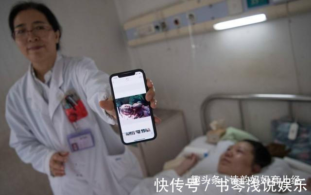 晴子|剖腹产手术中,医生还会顺带帮你做这几个手术,看看你中标了吗?