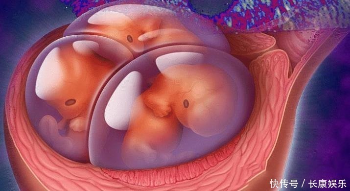 孕妇|孕妇怀孕3个月,肚子大到行动不便,孕检后一家人很纠结