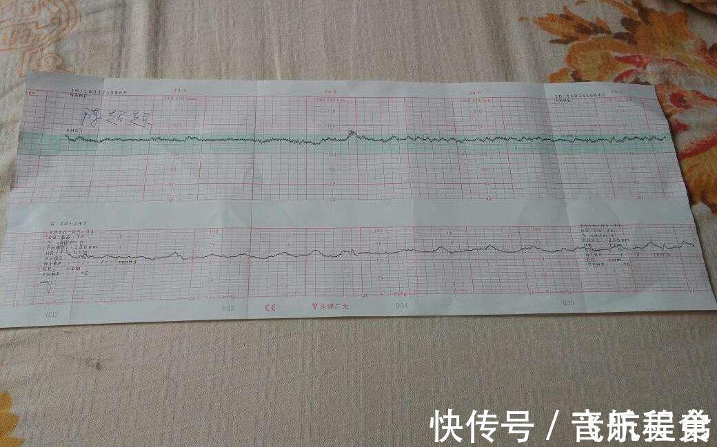 四维彩超|怀“小王子”的宝妈，身上有这4大特征，赶快接好孕吧