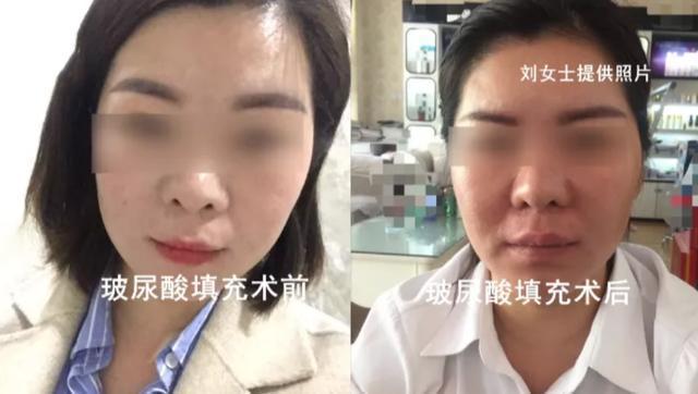 嘟嘟唇|美容店老板娘整容“翻车”,前后对比惨不忍睹让我咋面对顾客