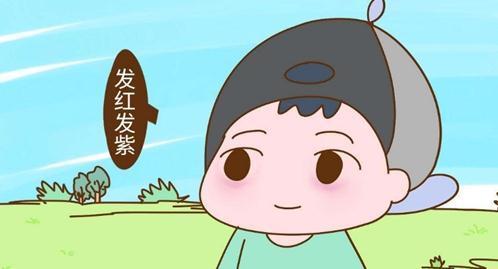 积食|宝宝脾胃虚弱,眼睛会变成这样子,快看你的宝宝有吗