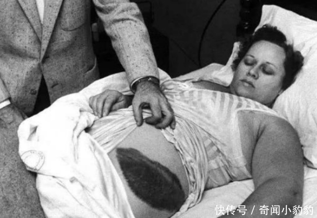 世界上首位被陨石砸中的人,本可以一夜暴富,却因贪婪而离婚!