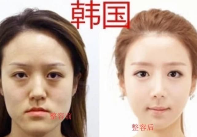 泰国|韩国我整容,日本我化妆,泰国我变性,中国都给我让让