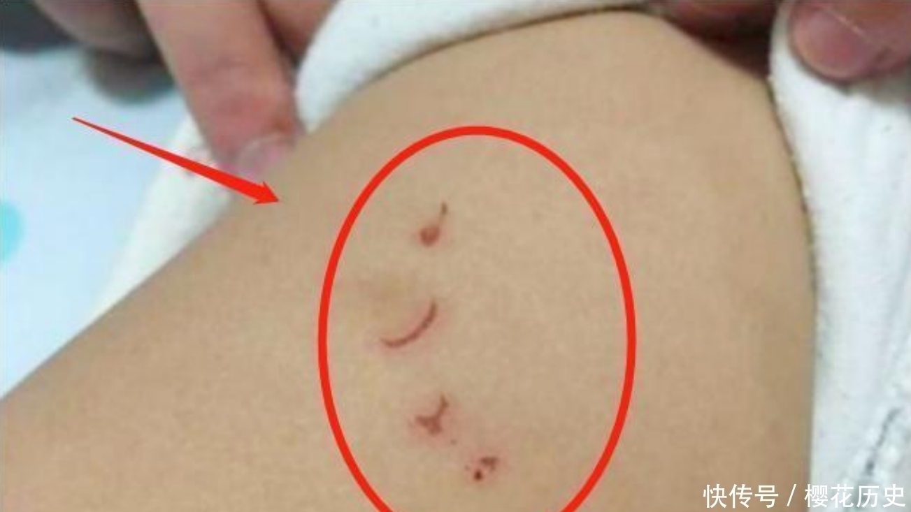 孩子|哥哥一亲近妹妹,妹妹却莫名哭闹,妈妈掀开妹妹衣服失声痛哭