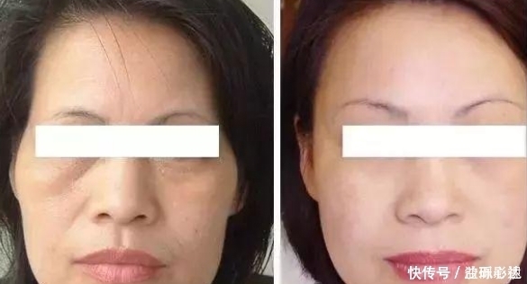 药店最不起眼的一款“精华液”,美白抗衰去皱纹,网友堪称平价兰蔻