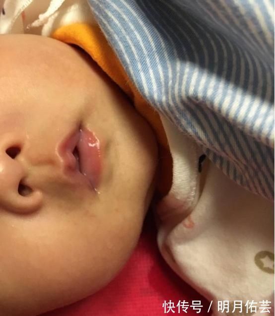 舌苔|宝宝有这4个表现,说明他积食,大人可别大意了,吃它积食消得快