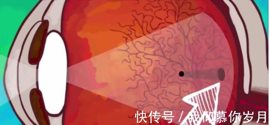 飞蚊|当你盯着某物不动时,眼前出现的浮游状的东西是什么?