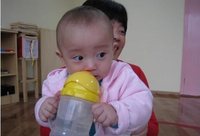 积食|双胞胎长期积食不在意，拖成“疳积”，儿科医生：家长无知造成的