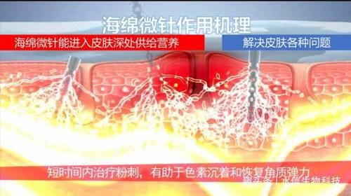 海绵微针可以解决皮肤各种问题[水信生物]