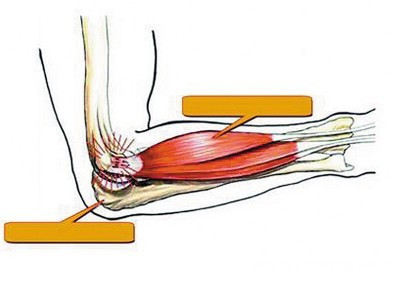 钓鱼|钓鱼人的“悲哀”也许这3种病就是我们的归宿,请不要再耍虎了!