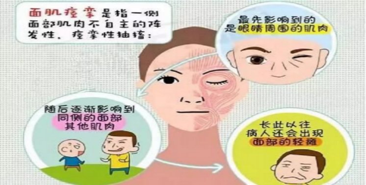 小脑|左眼跳财，右眼跳灾？不管哪边跳，都要当心这种疾病！