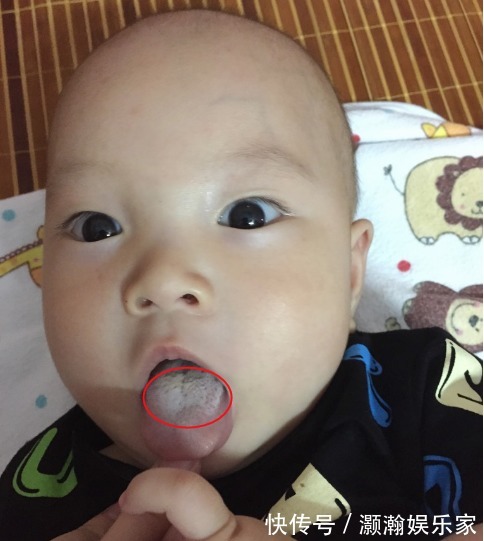 积食|如果宝宝发出7种表现,说明是身体“积食”了,家长别忽视