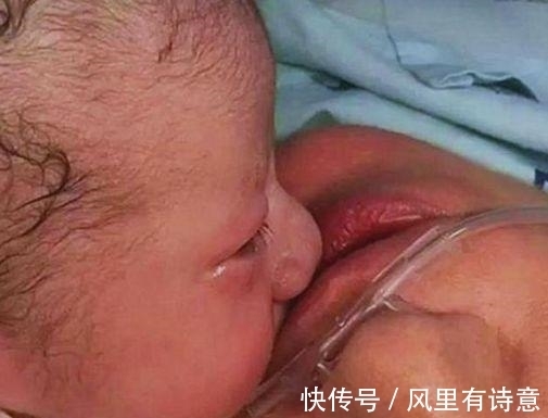 抢救|母亲生下宝宝后没抢救过来,宝宝的做法感动了整个世界!