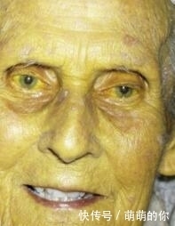 无特殊|爱喝酒的人,身上若没有3种“异常”,恭喜,你的肝还算不错!