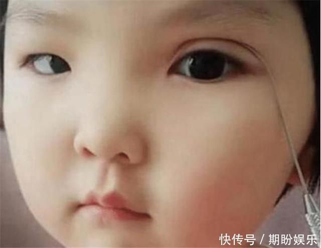 孩子不是双眼皮,家长亲自给整成双眼皮,网友:无知