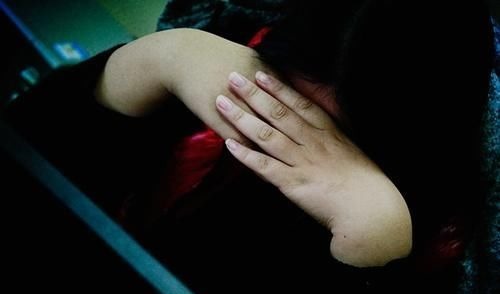 升高|血压多高可能引发脑出血?医生给出参考值,高血压患者需留意