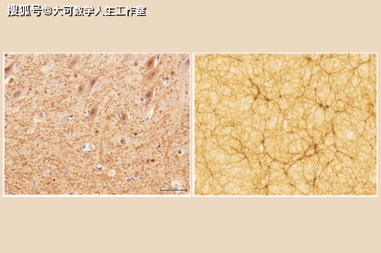 我们的大脑和宇宙，具有惊人的相似性