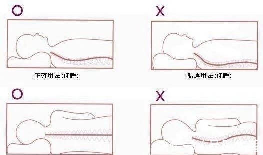 弧度|预防颈椎病，睡眠姿势很关键，听听医怎么说