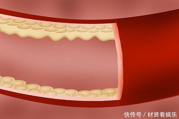 女子为了抗衰老，每晚睡前服用维生素E，她的身体最后怎么样了