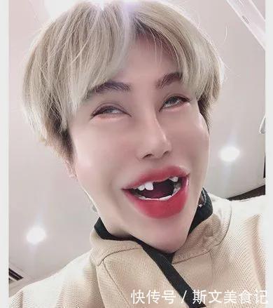 艾伦|日本一帅气小伙花1亿做全身整容,最后终于整成了“悲伤蛙”