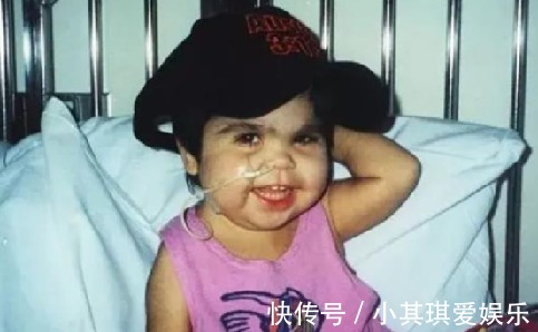 名人传|女童出生便患美人鱼症,喜欢呆在水里,用乐观打败缺陷