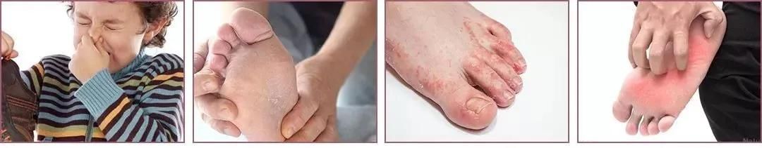 踩屎感|今夏超火的“踩屎感”拖鞋，踩着软，走着轻，速干不臭脚