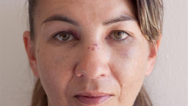 生化|脾虚百病生脾有“三怕”,多吃“一果”,健脾祛湿一步到位