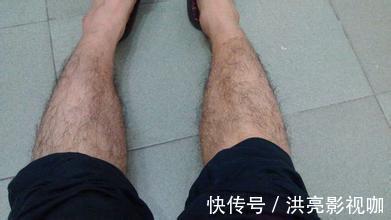 长寿|男女一样,此处“毛”越多可能越长寿,很多人却嫌丑