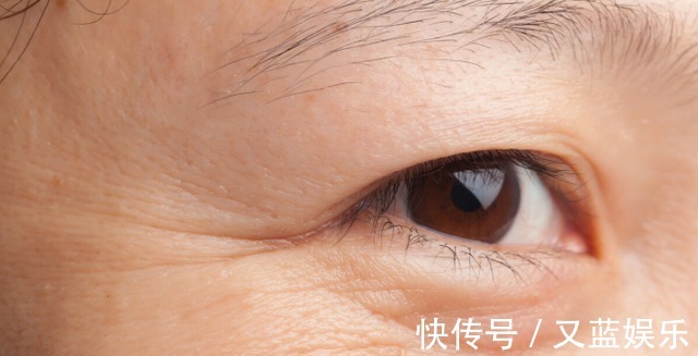 脸部|吃水果能抗衰老?皮肤科医生:2种食物也可多吃,或可消除皱纹