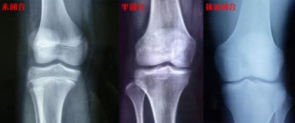 玮玮|2物是长个“抑制剂”,娃儿经常吃身高或会减少9公分