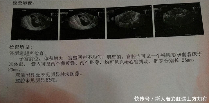 孕妇|确定怀孕后,第一次产检是在什么时候?超过这个时间,就晚了