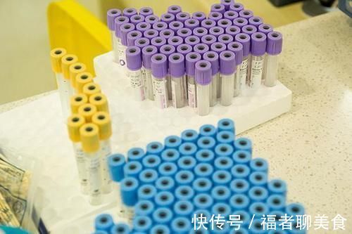 检查|肿瘤标志物检查，靠不靠谱？意义到底是什么？