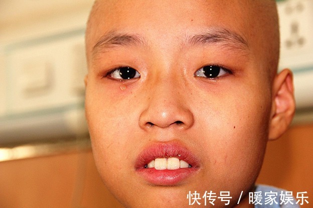去世|爸爸奶奶等4名至亲相继患癌去世，10岁女孩也患癌现在轮到我了