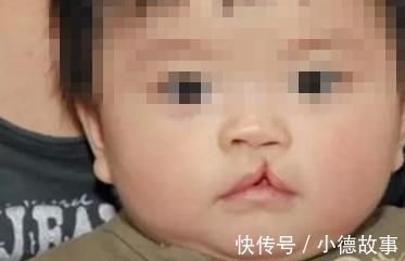 孕期|产妇生出“兔唇儿”,谎称孕期吃了兔肉,被揭穿后婆婆很生气