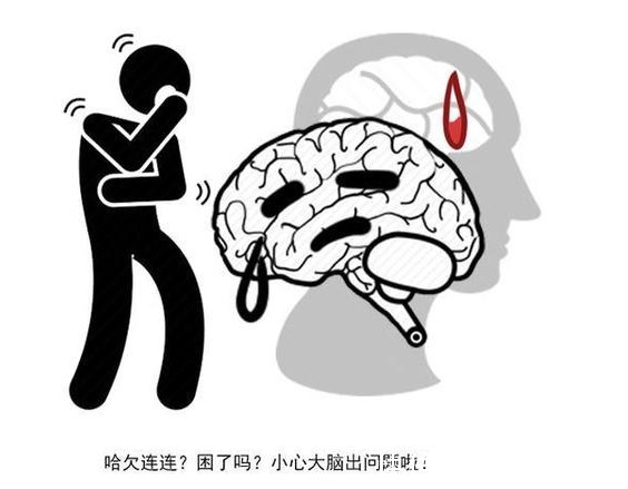 骑自行车|如果4个症状全有,很遗憾,脑梗已缠上你,做好4点,脑血管会更好