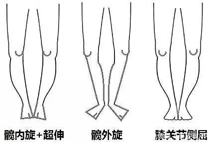 美女|花大价钱买来的裤子，穿上不合适？原来没有“按照腿型”选款式