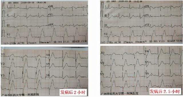 临床医生|现代中医诊治新思维-麝香保心丸抗冠脉微循环障碍初探