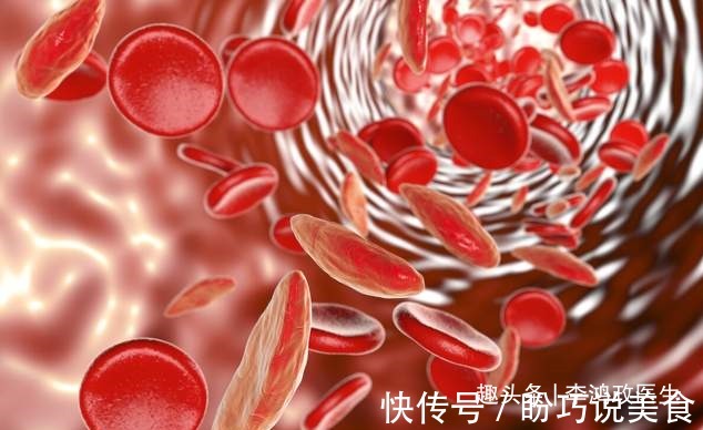 妇科医生|女子头晕半年,以为患癌症,检查结果让她觉得重获新生