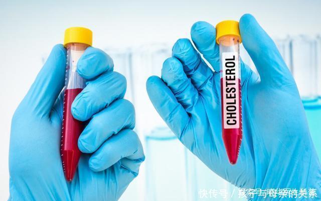 风险|50岁后,每十年脑梗风险增加一倍,医生:坚持3件事,血管才更好