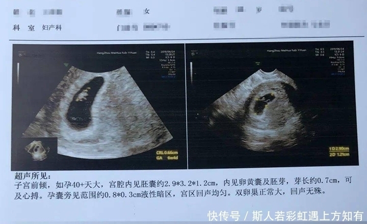 孕妇|确定怀孕后，第一次产检是在什么时候？超过这个时间，就晚了