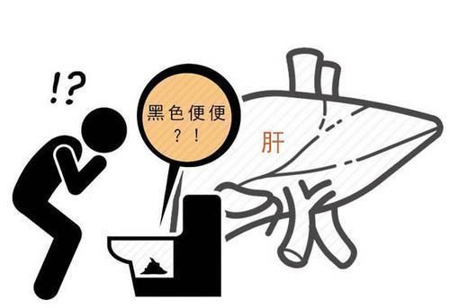 肝脏|上厕所出现4个“迹象”,赶紧检查下肝脏,肝脏疾病已经严重了